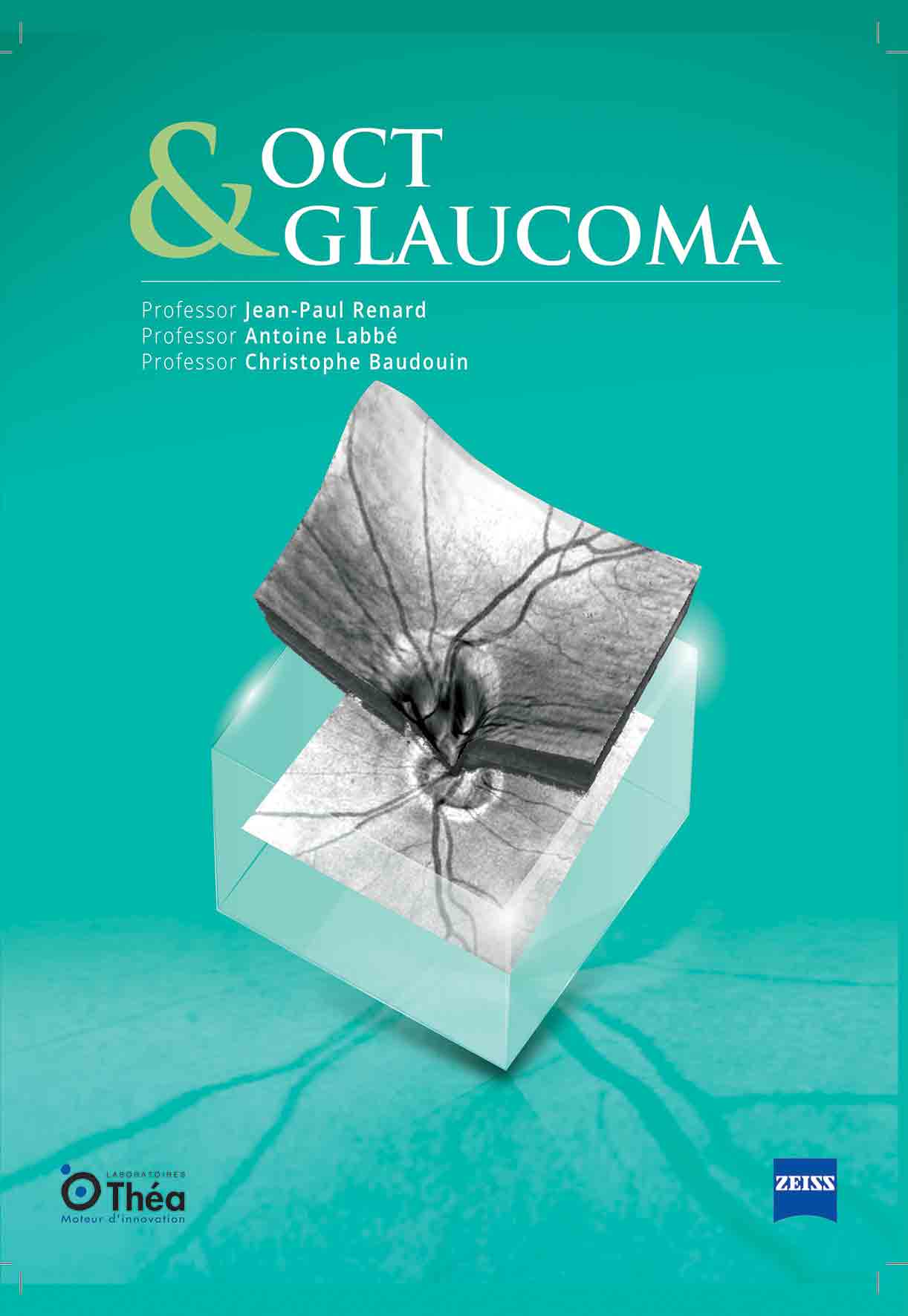 OCT & GLAUCOMA